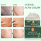 La cicatrice di pulizia di erbe organica naturale dell'acne di cura di pelle della crema di fronte rimuove il trattamento